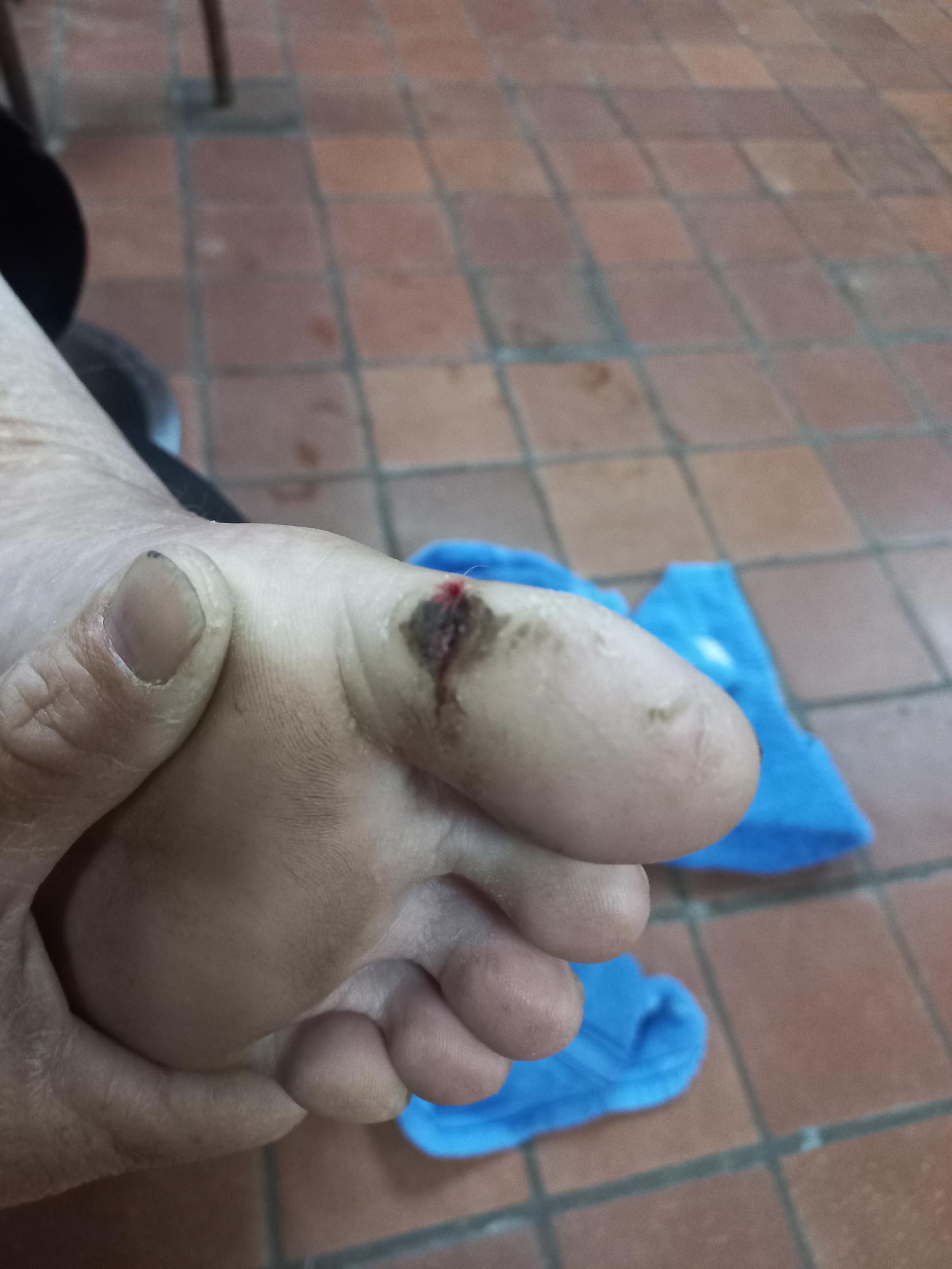 Allegations of mistreatment of patients and unqualified Carers surfaces at Vrystaatnasorg